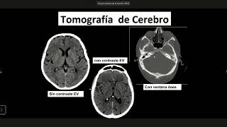 videoimagen claseincompleta Dr Rodriguez