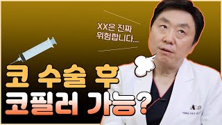 코수술 후 코필러 맞아도 될까?? 고민하시는 분들! 여기만큼은 참아주세요..!! - 의학박사 백승준