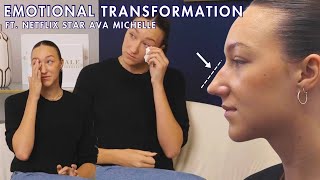 Emotional Rhinoplasty On Netflix Tall Girl, Ava Michelle