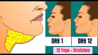 How to Get Rid of Double Chin | Yoga & Stretches: Defined Jawline