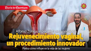 Rejuvenecimiento vaginal, un procedimiento innovador