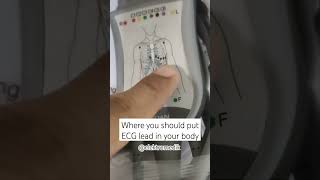 This is how you put an ECG lead into your body/patient body #ECG #health #tech #healthcare #viral