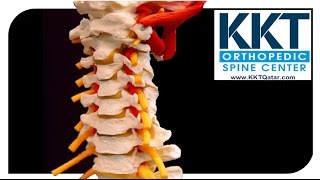 KKT Qatar Non invasive treatment for back pain and spine care