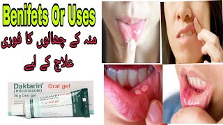 Daktarin Oral Gel How To Use In Urdu/Hindi | Mouth Ulcer Medicine | Muh Ke Chhale Ka ilaj