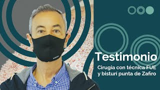 👉🏼Testimonio tras un INJERTO CAPILAR |  TRASPLANTE CAPILAR 10 días después de la cirugía💯