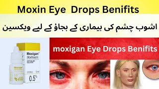 Moxigan eye drop|ankh ki allergy ka drop||ankh ki infection ka drop||eye drops||ankh ka drops|