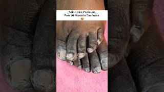 😱Feet Brightening Mask| Fair  Feet in 1 Day| #pedicure #skincare #shortsvideo#trending #viralshort