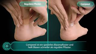 Wieso sollte man Compeed statt reguläre Pflaster zur Behandlung von Blasen nutzen?