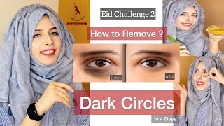 Remove Dark Circles in 4 Days || Eid Challenge 2 || Guaranteed Results