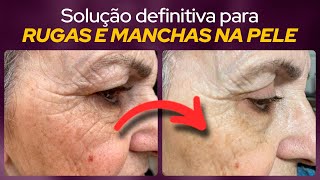 Parece mágica RUGAS e MANCHAS vão SUMIR | Momento Beleza & Saúde