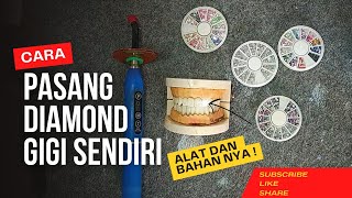 Cara Memasang Diamond Gigi Sendiri Dengan Mudah Dan Kuat