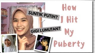 Suntik Putih? Krim Pemutih? GIGI LUMUT(AN)? | HOW I HIT MY PUBERTY