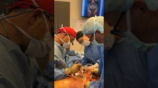 Watch as our expert surgery team transforms this patients entire lower body! 👨‍⚕️👩‍⚕️