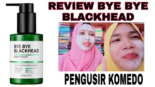 Komedo Hilang Pakai Bye Bye Blackhead 😍