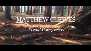 Matthew Clewes - Teeth (Casey cover)