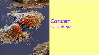 Cancer [GCSE Biology]