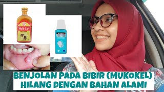 BENJOLAN PADA BIBIR (MUKOKEL) HILANG DENGAN BAHAN ALAMI‼️VERSI RANGKUMAN‼️