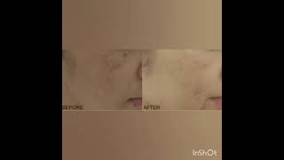 Skin Quality And Rejuvenation