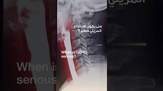 When is GERD serious? | Dr. Louay Roueili | Reem Hospital Abu Dhabi