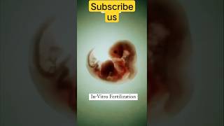 in vitro fertilisation #healthylifestyle #fertilisation #invitrofertilisation