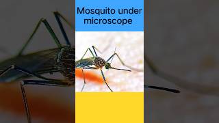 #insects #mosquito #microscopics #mosquitoe #shortsvideo #microbiology #scary #mbbsdreams