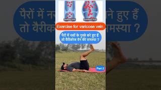 Treatment for varicose vein at home #yoga #fitness #ytshorts