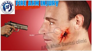 Fire Arm Injury