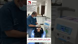 علاج أسنان الأطفال بالغاز الضاحك