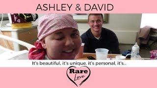 Cancer Survivor Shares Miracle Story | Rare Love