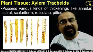 Plant Anatomy: Types of Complex Tissue: Xylem