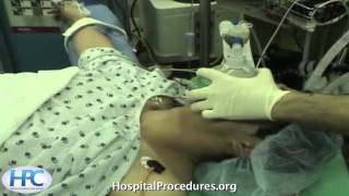 Laryngeal Mask Airway LMA video