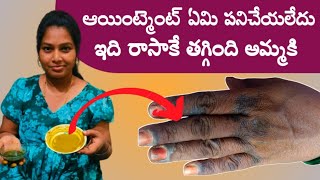 ఇది రాసాక తగ్గిపోయింది ||Skin Allergy Homeremedy to reduce skinrashes|Itching, tips&tricks