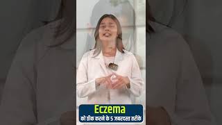 Psoriasis eczema | Eczema को ठीक करने के 5 जबरदस्त तरीके | Eczema Homeopathy Treatment #shorts