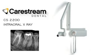 Carestream Dental CS 2200 Intraoral X Ray System