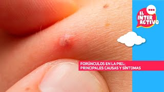 Infecciones cutáneas: diferencias entre forúnculos, quistes y absceso