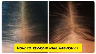 How to Regrow Hair Naturally.. Grow long hair fast naturally..