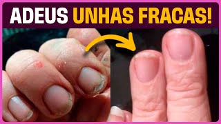 Tratamento natural para unhas descamando e manchas na pele em menos de 2 meses com Óleos Essenciais