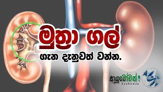 මුත්‍රා ගල්  Urine stones #ආයුබෝවන් #Ayubowan