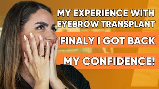 MY EYEBROW TRANSPLANT Experience | Marina