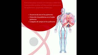 Gammagrama Pulmonar