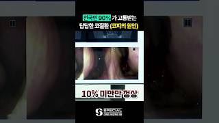 비중격만곡증의 심각성