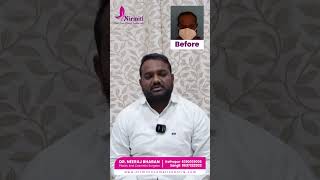 Hair Transplant Testimonial -- Happy Customer from Pune