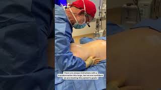 Patient Journey: Tummy Tuck, BBL, Liposuction + Skin Tightening