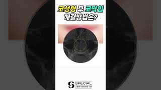 코성형 후 코막힘 피하는 방법 #shorts