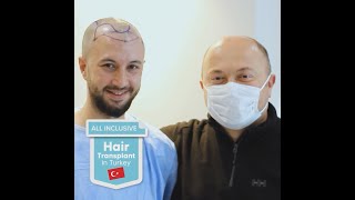 Hair Transplant in Turkey I Hair Loss Solution I Clinic International