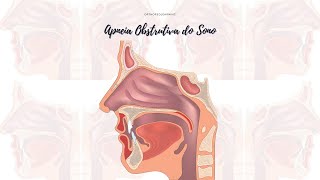 CURSO: APNEIA OBSTRUTIVA DO SONO