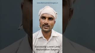 Successful Foot Transplant Surgery by Dr. R. K. Mishra in Lucknow #FootTransplant #LimbTransplant