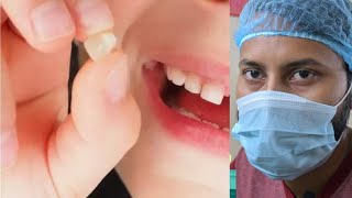 Zirconia दांत कैसे बनते हैं  | zirconia dant ki kimat | zirconia crown tooth 🦷