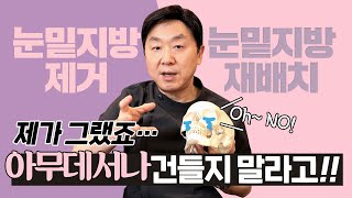 눈밑지방제거vs눈밑지방재배치 안 똑같아요 ! '이것' 이 다릅니다.  - 의학박사 백승준