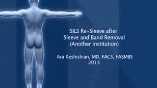 SILS™ Re-Sleeve after Sleeve and Band Removal